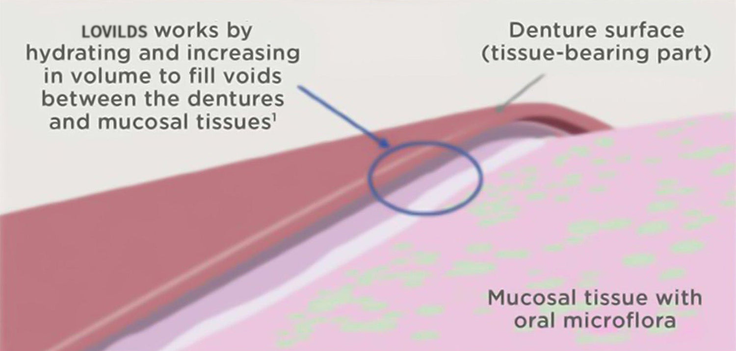 Lovilds™ Thermoplastic Denture Adhesive 41 1 4 5
